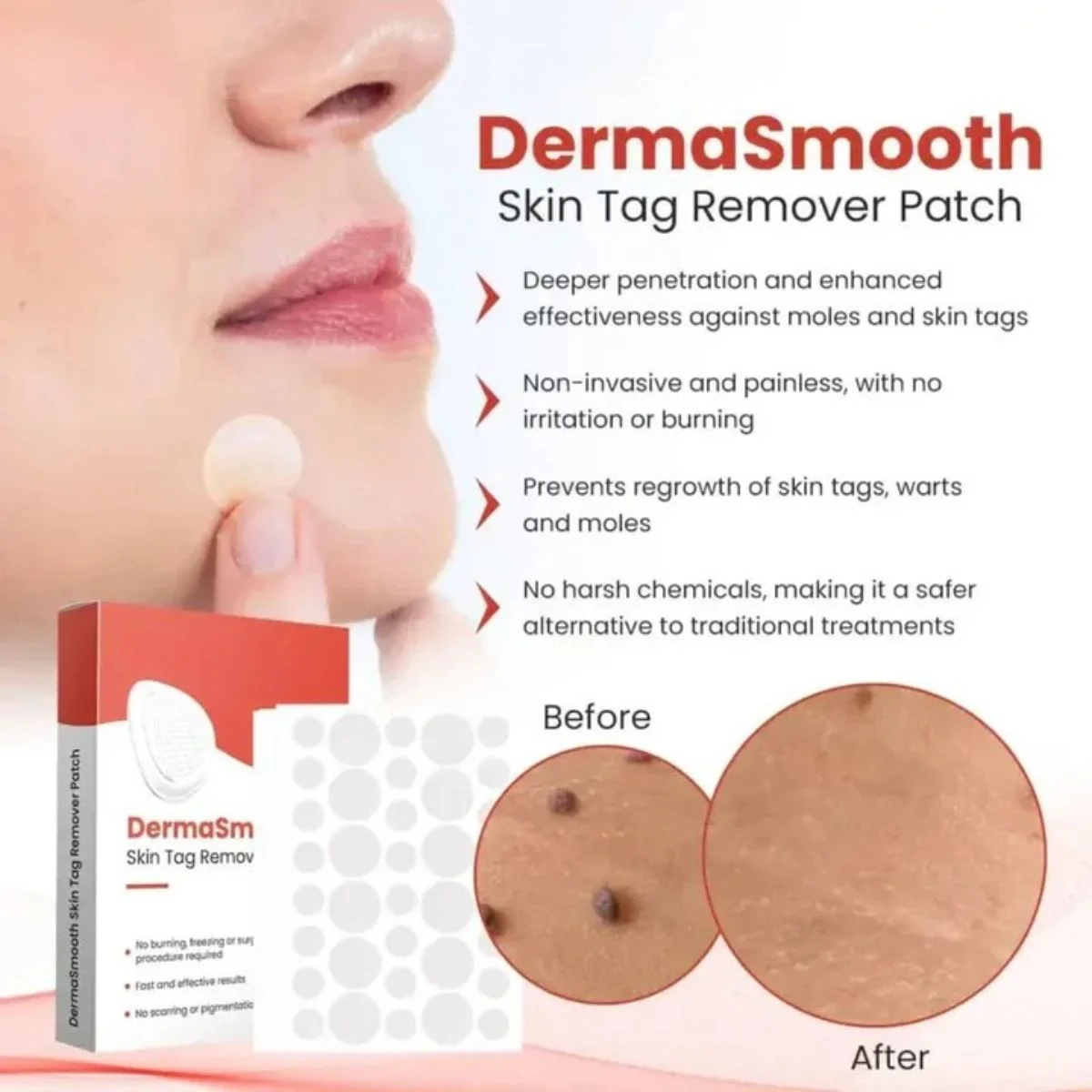 DermaSmooth Skin Tag Remover Patch | Fast, Safe & Painless Skin Tag & Mole Removal | Nano-Microneedle Technology | 72 Patches - Image 3