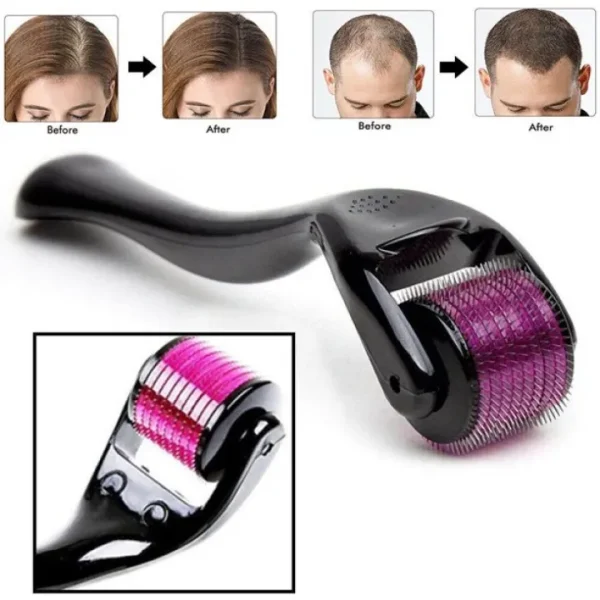 Derma Roller 0.5mm for Hair & Skin Therapy | 540 Titanium Micro-Needles - Image 4